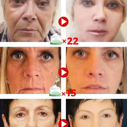 Wrinkles disappear Become beautiful now