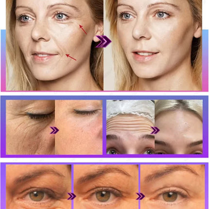 Wrinkles disappear Become beautiful now